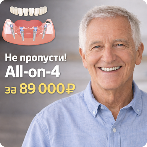 Не пропусти! All-on-4
